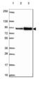 N-Acylsphingosine Amidohydrolase 2 antibody, NBP2-49326, Novus Biologicals, Western Blot image 