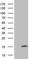 Matrix Gla protein antibody, M01702, Boster Biological Technology, Western Blot image 