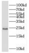 Scm Polycomb Group Protein Like 1 antibody, FNab07639, FineTest, Western Blot image 