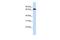 Solute Carrier Family 6 Member 1 antibody, GTX46843, GeneTex, Western Blot image 