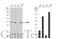 Proteasome Inhibitor Subunit 1 antibody, GTX104760, GeneTex, Western Blot image 