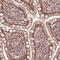Bromodomain Containing 9 antibody, NBP2-58517, Novus Biologicals, Immunohistochemistry paraffin image 