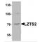 Leucine Zipper Tumor Suppressor 2 antibody, MBS151150, MyBioSource, Western Blot image 