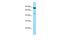 Phosphatidylinositol-5-Phosphate 4-Kinase Type 2 Gamma antibody, A10431, Boster Biological Technology, Western Blot image 