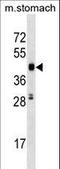 Cyclin Dependent Kinase 18 antibody, LS-C164329, Lifespan Biosciences, Western Blot image 