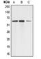 Aladin WD Repeat Nucleoporin antibody, LS-C353028, Lifespan Biosciences, Western Blot image 