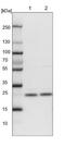 Zinc Finger Matrin-Type 2 antibody, NBP1-82026, Novus Biologicals, Western Blot image 