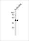 Peroxisome Proliferator Activated Receptor Delta antibody, LS-C163890, Lifespan Biosciences, Western Blot image 