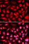 ETS Proto-Oncogene 1, Transcription Factor antibody, 14-902, ProSci, Immunofluorescence image 