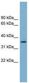 Acyl-CoA Wax Alcohol Acyltransferase 1 antibody, TA336101, Origene, Western Blot image 