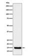 Fission, Mitochondrial 1 antibody, M01932-1, Boster Biological Technology, Western Blot image 