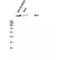 ATM Serine/Threonine Kinase antibody, LS-C382214, Lifespan Biosciences, Western Blot image 