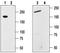 Transient Receptor Potential Cation Channel Subfamily M Member 7 antibody, TA328749, Origene, Western Blot image 