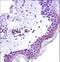 Signal Transducer And Activator Of Transcription 2 antibody, LS-C161548, Lifespan Biosciences, Immunohistochemistry frozen image 