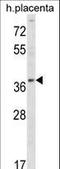 Ubiquitin Conjugating Enzyme E2 Q2 antibody, LS-C160386, Lifespan Biosciences, Western Blot image 