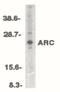 Nucleolar Protein 3 antibody, PA5-19934, Invitrogen Antibodies, Western Blot image 