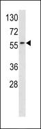 Receptor Like Tyrosine Kinase antibody, 63-136, ProSci, Western Blot image 