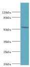 Hyaluronidase 2 antibody, MBS1497033, MyBioSource, Western Blot image 