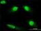 Diaphanous Related Formin 3 antibody, H00081624-M01, Novus Biologicals, Immunocytochemistry image 