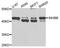 Inhibin Subunit Beta B antibody, STJ111289, St John