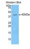 Pyruvate Dehydrogenase E1 Alpha 1 Subunit antibody, LS-C296163, Lifespan Biosciences, Western Blot image 