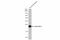 Lipocalin 2 antibody, GTX132773, GeneTex, Western Blot image 