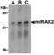 Interleukin 1 Receptor Associated Kinase 2 antibody, MBS150516, MyBioSource, Western Blot image 