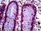 C-C chemokine receptor type 1 antibody, orb94496, Biorbyt, Immunohistochemistry paraffin image 