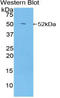 Nuclear Receptor Subfamily 3 Group C Member 1 antibody, LS-C700966, Lifespan Biosciences, Western Blot image 