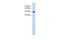 Solute Carrier Family 38 Member 1 antibody, A04461, Boster Biological Technology, Western Blot image 