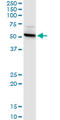 Cystinosin, Lysosomal Cystine Transporter antibody, LS-B10982, Lifespan Biosciences, Western Blot image 