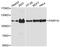 Poly(ADP-Ribose) Polymerase Family Member 10 antibody, A12815, ABclonal Technology, Western Blot image 