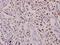 Nuclear Cap Binding Protein Subunit 1 antibody, A07424-2, Boster Biological Technology, Immunohistochemistry frozen image 