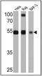 ST6 Beta-Galactoside Alpha-2,6-Sialyltransferase 1 antibody, MA5-11900, Invitrogen Antibodies, Western Blot image 