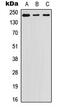 Laminin Subunit Beta 1 antibody, abx121510, Abbexa, Western Blot image 