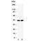 Branched Chain Amino Acid Transaminase 1 antibody, R30615, NSJ Bioreagents, Western Blot image 