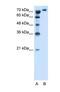 Solute Carrier Family 6 Member 18 antibody, NBP1-59903, Novus Biologicals, Western Blot image 