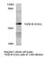 Transforming Growth Factor Beta Receptor 1 antibody, LS-C177437, Lifespan Biosciences, Western Blot image 