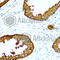 Acid Phosphatase, Prostate antibody, A1937, ABclonal Technology, Immunohistochemistry paraffin image 