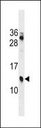 Putative protein KRIP1 antibody, PA5-72091, Invitrogen Antibodies, Western Blot image 