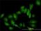 Galectin 1 antibody, H00003956-M01, Novus Biologicals, Immunocytochemistry image 