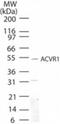 Activin A Receptor Type 1 antibody, NB100-56432, Novus Biologicals, Western Blot image 