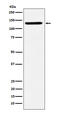 Splicing Factor 3b Subunit 3 antibody, M08240-1, Boster Biological Technology, Western Blot image 