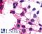 P2Y purinoceptor 12 antibody, LS-A3742, Lifespan Biosciences, Immunocytochemistry image 