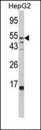 Matrix Metallopeptidase 1 antibody, orb214254, Biorbyt, Western Blot image 