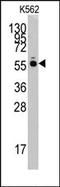 Histidyl-tRNA synthetase, cytoplasmic antibody, AP14214PU-N, Origene, Western Blot image 