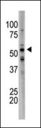 NK2 Homeobox 2 antibody, orb248484, Biorbyt, Western Blot image 