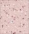 Formin 2 antibody, NBP2-24615, Novus Biologicals, Immunohistochemistry paraffin image 