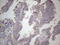 DHSB antibody, LS-C794251, Lifespan Biosciences, Immunohistochemistry paraffin image 