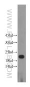 HD Domain Containing 3 antibody, 21091-1-AP, Proteintech Group, Western Blot image 